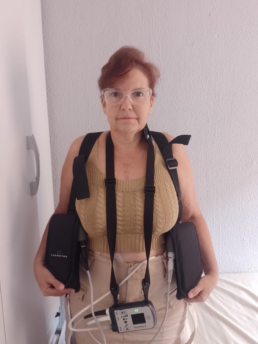 Cajamarense está entre as três pessoas no Estado a receber coração artificial pelo SUS